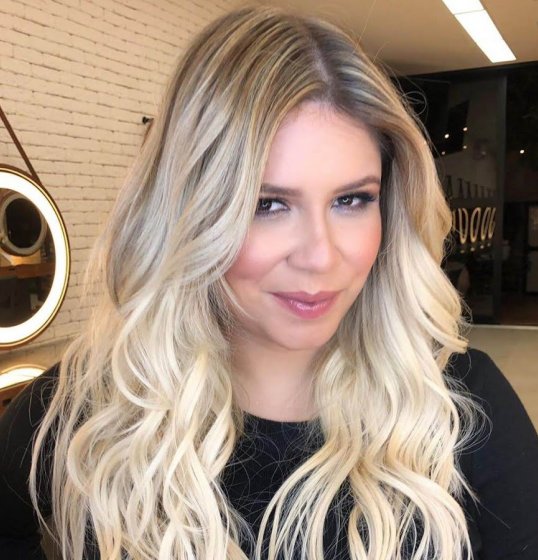 Marília Mendonça compartilha resultado de preenchimento labial Marília Mendonça compartilha resultado de preenchimento labial