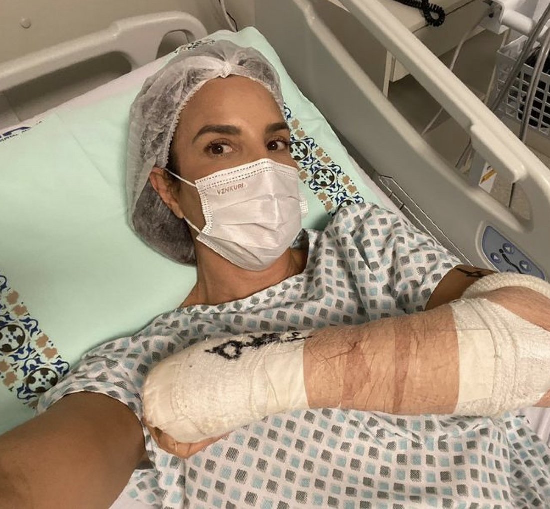 [Ivete Sangalo tranquiliza os fãs após a cirurgia: 